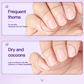 💅3-in-1 Nail Care Serum Oil Pen – Cuticle Remover, Nail Polish Remover & Nail Oil Treatment