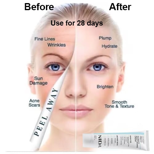 ✨ 2025 HOT SALE🎉💝NIDA Youthful Formula Ultimate Moisturizing Cream