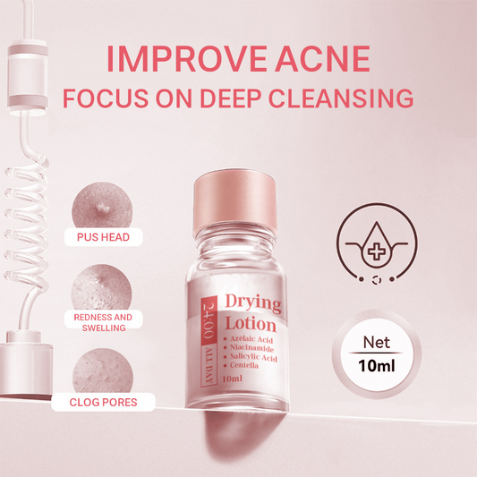 🔥LAST DAY SALE🎁 Buy 1 Get 1 Free🎉Salicylic Acid Spot Drying Lotion✨