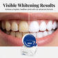 🔥Last Day Buy 2 Get 1 Free(3 Pcs)🪥💧Probiotic Teeth Whitening Powder