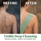 📢📢60% OFF !! ⏰Buy 1 Get 1 Free🛁Deep Cleansing Silicone Back Scrubber🫧🧼