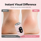 🦶 Electric Foot Grinder – Smooth Feet with 6 Speeds & 5 Heads ✨💖